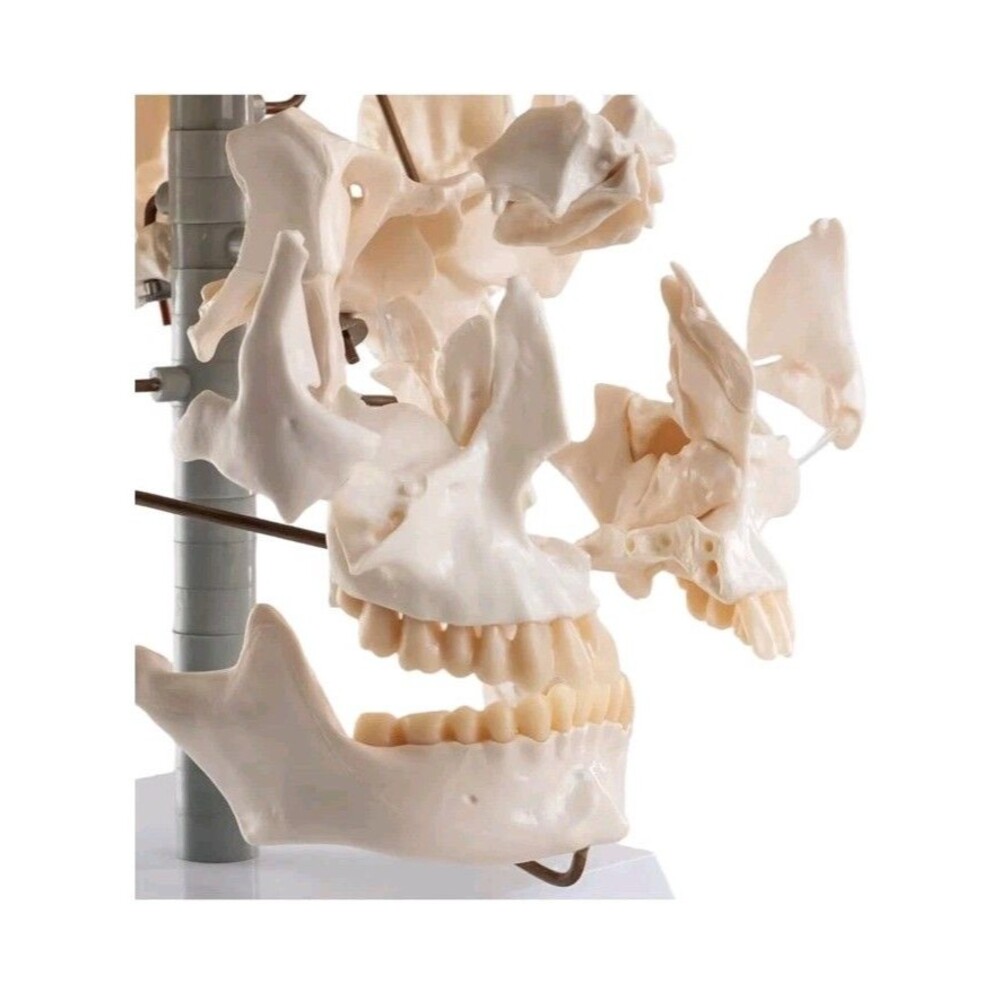 22-Piece Exploded Human Skull Model, Full Size, Bone Color Disassembled Cranial - Picture 6 of 12